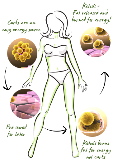 ketosis